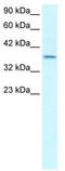 SMAD Family Member 7 antibody, TA329746, Origene, Western Blot image 