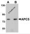Anaphase Promoting Complex Subunit 5 antibody, 5727, ProSci Inc, Western Blot image 