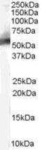 MDM2 Proto-Oncogene antibody, PA5-18444, Invitrogen Antibodies, Western Blot image 