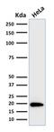 Ferritin Light Chain antibody, GTX34722, GeneTex, Western Blot image 