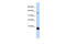 Tachykinin 3 antibody, 25-763, ProSci, Western Blot image 