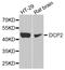 Decapping MRNA 2 antibody, STJ110581, St John