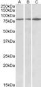 Terminal Nucleotidyltransferase 4B antibody, STJ72555, St John