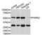 Parkin RBR E3 Ubiquitin Protein Ligase antibody, abx125426, Abbexa, Western Blot image 