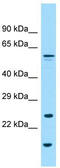 Glypican 6 antibody, TA338144, Origene, Western Blot image 