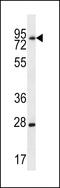 LIM Domains Containing 1 antibody, 56-870, ProSci, Western Blot image 