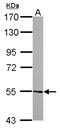 Arginyltransferase 1 antibody, NBP2-15494, Novus Biologicals, Western Blot image 