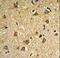 Iodothyronine Deiodinase 2 antibody, LS-C167417, Lifespan Biosciences, Immunohistochemistry paraffin image 