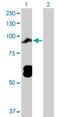 DNA Topoisomerase III Beta antibody, H00008940-D01P, Novus Biologicals, Western Blot image 
