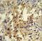 Uridine Phosphorylase 2 antibody, LS-C160449, Lifespan Biosciences, Immunohistochemistry paraffin image 