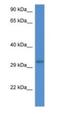 UBX Domain Protein 2A antibody, NBP1-74162, Novus Biologicals, Western Blot image 