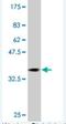 RAB31, Member RAS Oncogene Family antibody, H00011031-M01, Novus Biologicals, Western Blot image 