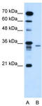 Lymphocyte Antigen 6 Family Member G6F antibody, TA335306, Origene, Western Blot image 