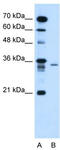 Lymphocyte Antigen 6 Family Member G6F antibody, TA335306, Origene, Western Blot image 