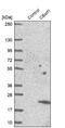 Small Integral Membrane Protein 29 antibody, NBP1-81323, Novus Biologicals, Western Blot image 