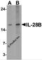 Interleukin-28B antibody, 7479, ProSci Inc, Western Blot image 