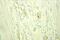 Apolipoprotein D antibody, 10520-1-AP, Proteintech Group, Immunohistochemistry paraffin image 