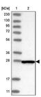 Centromere Protein H antibody, NBP1-82546, Novus Biologicals, Western Blot image 