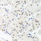 High Mobility Group Nucleosome Binding Domain 1 antibody, abx006321, Abbexa, Western Blot image 