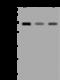 DNA Topoisomerase II Alpha antibody, 101145-T32, Sino Biological, Western Blot image 