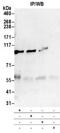 Protein Kinase D2 antibody, NB100-636, Novus Biologicals, Western Blot image 