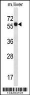 Solute Carrier Family 45 Member 3 antibody, 58-006, ProSci, Western Blot image 