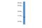 Secretory Carrier Membrane Protein 5 antibody, A10766, Boster Biological Technology, Western Blot image 