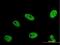 ERH MRNA Splicing And Mitosis Factor antibody, H00002079-M14, Novus Biologicals, Immunocytochemistry image 