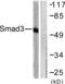 SMAD Family Member 3 antibody, LS-C117540, Lifespan Biosciences, Western Blot image 