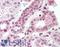 TG(Z) antibody, LS-B9533, Lifespan Biosciences, Immunohistochemistry paraffin image 