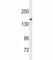 Lysine Demethylase 6B antibody, F45614-0.4ML, NSJ Bioreagents, Western Blot image 