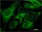 Carboxypeptidase A4 antibody, H00051200-M07, Novus Biologicals, Immunocytochemistry image 
