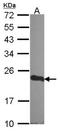 Cysteine And Glycine Rich Protein 1 antibody, NBP2-14919, Novus Biologicals, Western Blot image 