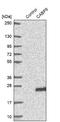 Calcium-binding protein 5 antibody, NBP1-86691, Novus Biologicals, Western Blot image 