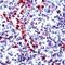 Granzyme B antibody, PA5-32434, Invitrogen Antibodies, Immunohistochemistry paraffin image 