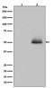 Glycogen Synthase Kinase 3 Alpha antibody, P03152-1, Boster Biological Technology, Western Blot image 