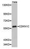 Cyclin Dependent Kinase Inhibitor 1C antibody, orb135247, Biorbyt, Western Blot image 