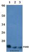 Follicle Stimulating Hormone Subunit Beta antibody, A01885-1, Boster Biological Technology, Western Blot image 