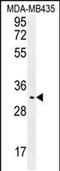 Olfactory Receptor Family 4 Subfamily K Member 2 antibody, PA5-48311, Invitrogen Antibodies, Western Blot image 