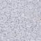 PCNA antibody, HPA030521, Atlas Antibodies, Immunohistochemistry paraffin image 