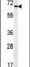 DExH-Box Helicase 58 antibody, PA5-25344, Invitrogen Antibodies, Western Blot image 