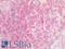 Chondroitin Sulfate Proteoglycan 4 antibody, LS-A12595, Lifespan Biosciences, Immunohistochemistry paraffin image 