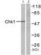 Checkpoint Kinase 1 antibody, LS-C118076, Lifespan Biosciences, Western Blot image 