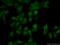 NOP2 Nucleolar Protein antibody, 10448-1-AP, Proteintech Group, Immunofluorescence image 