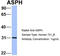 Aspartate Beta-Hydroxylase antibody, TA339206, Origene, Western Blot image 