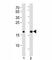 High Mobility Group AT-Hook 2 antibody, F52992-0.4ML, NSJ Bioreagents, Western Blot image 