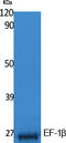 Eukaryotic Translation Elongation Factor 1 Beta 2 antibody, STJ96394, St John