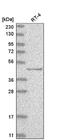 Tumor Protein P73 antibody, NBP2-58335, Novus Biologicals, Western Blot image 