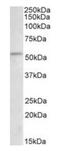 Checkpoint Kinase 1 antibody, orb137164, Biorbyt, Western Blot image 