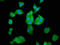 Histidine ammonia-lyase antibody, LS-C670320, Lifespan Biosciences, Immunofluorescence image 